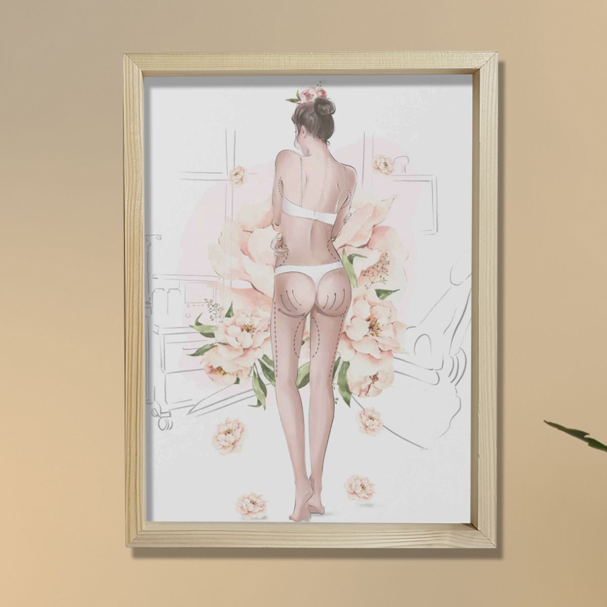 Plastik Cerrah Ameliyat İşaretleri,  Plastik ve Estetik Cerrahı, Doktor Odası Duvar Tablosu