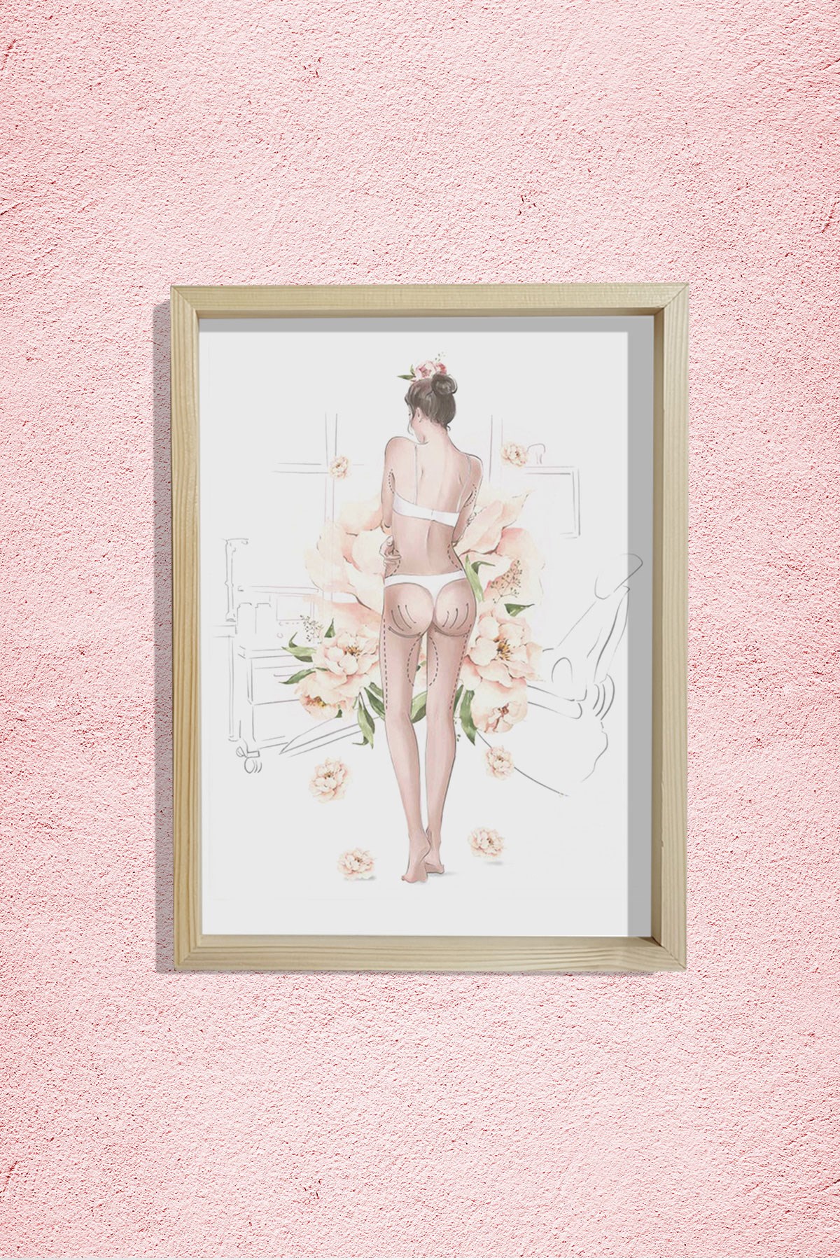 Plastik Cerrahı Ameliyat İşaretleri, Doktor Odası Duvar Tablosu