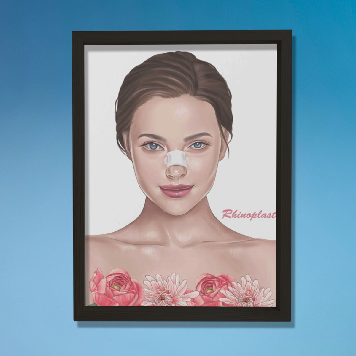 Rinoplasti, Rekonstrüktif Cerrahi, Plastik ve Estetik Cerrahı, Doktor Odası Duvar Tablosu