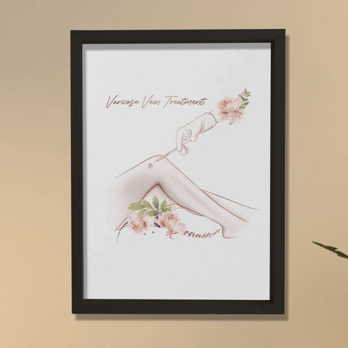 Varis Tedavisi, Estetik Sanat, Plastik ve Estetik Cerrahı, Doktor Odası Duvar Tablosu