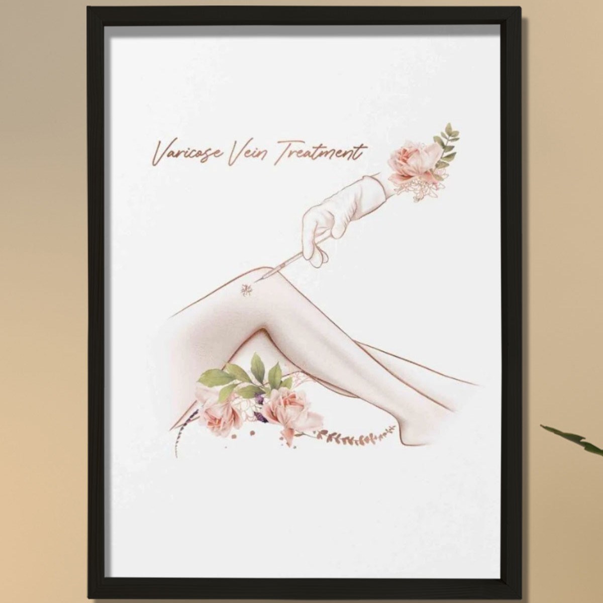 Varis Tedavisi, Estetik Sanat, Plastik ve Estetik Cerrahı, Doktor Odası Duvar Tablosu