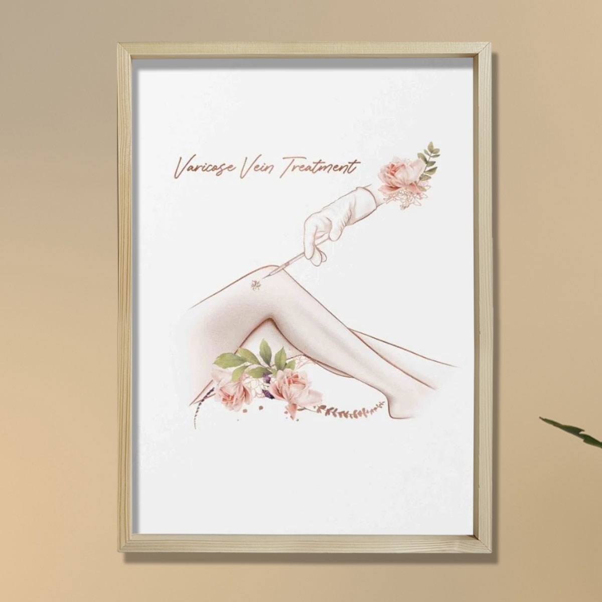 Varis Tedavisi, Estetik Sanat, Plastik ve Estetik Cerrahı, Doktor Odası Duvar Tablosu