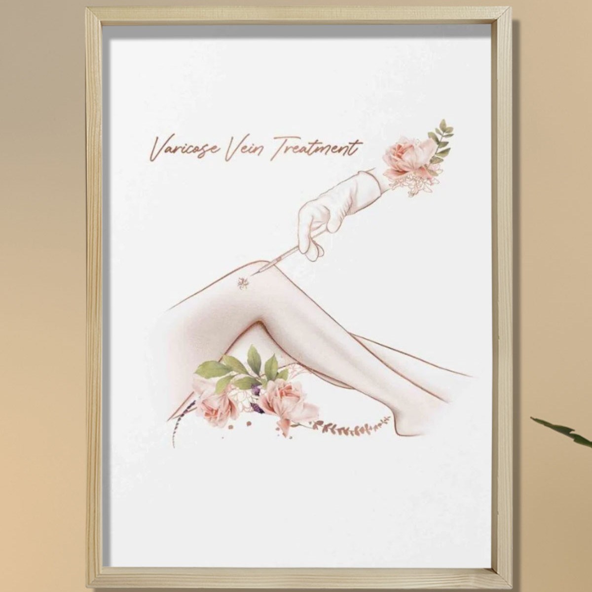 Varis Tedavisi, Estetik Sanat, Plastik ve Estetik Cerrahı, Doktor Odası Duvar Tablosu