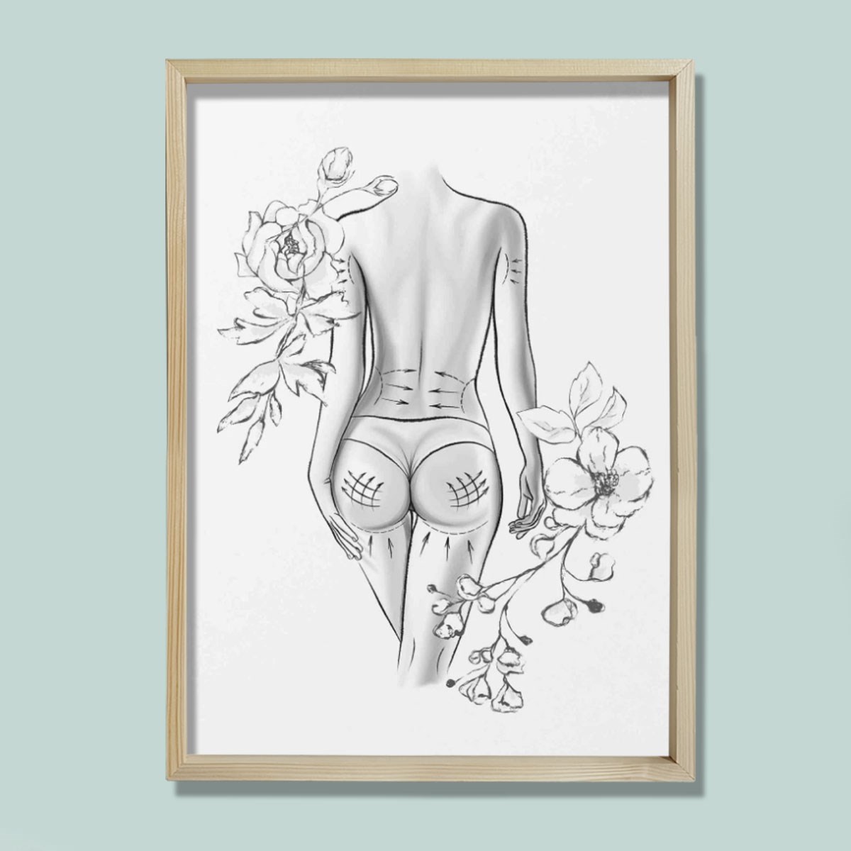 Vücut İşaretleme, Rekonstrüktif Cerrahi, Plastik ve Estetik Cerrahı, Doktor Odası Duvar Tablosu