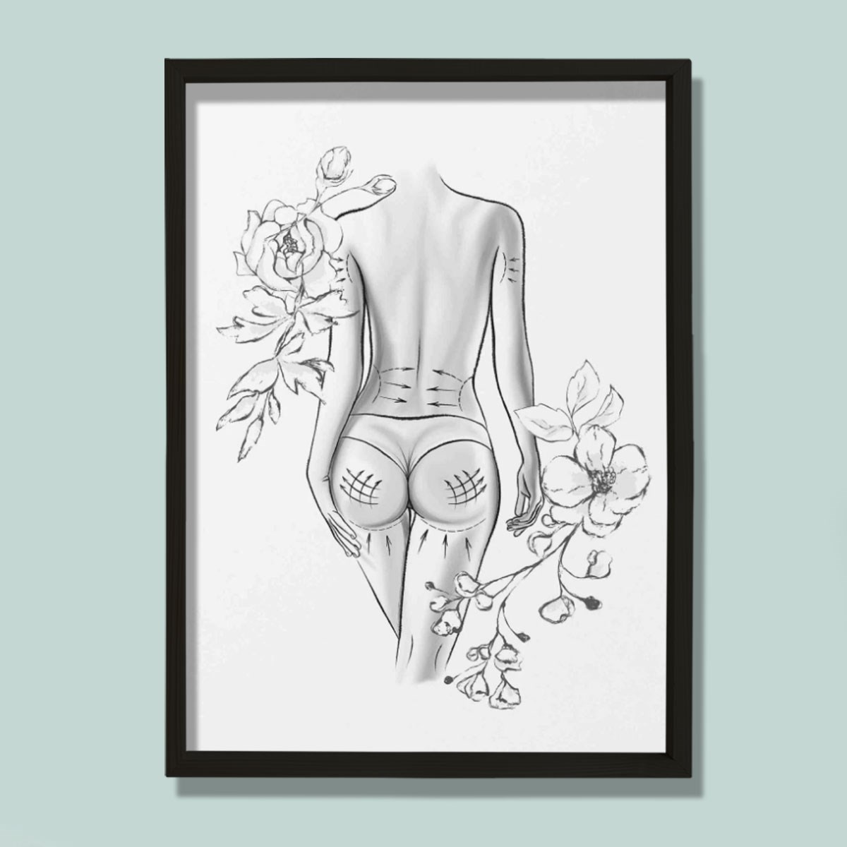 Vücut İşaretleme, Rekonstrüktif Cerrahi, Plastik ve Estetik Cerrahı, Doktor Odası Duvar Tablosu