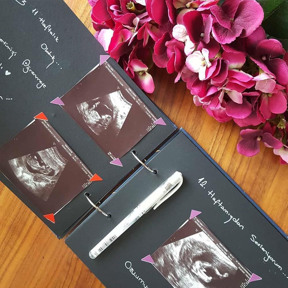 Badem Çiçekleri Tasarımlı Fotoğraf Albümü Anı Defteri; Beyaz Kalem ve Yapıştırıcı Hediyeli