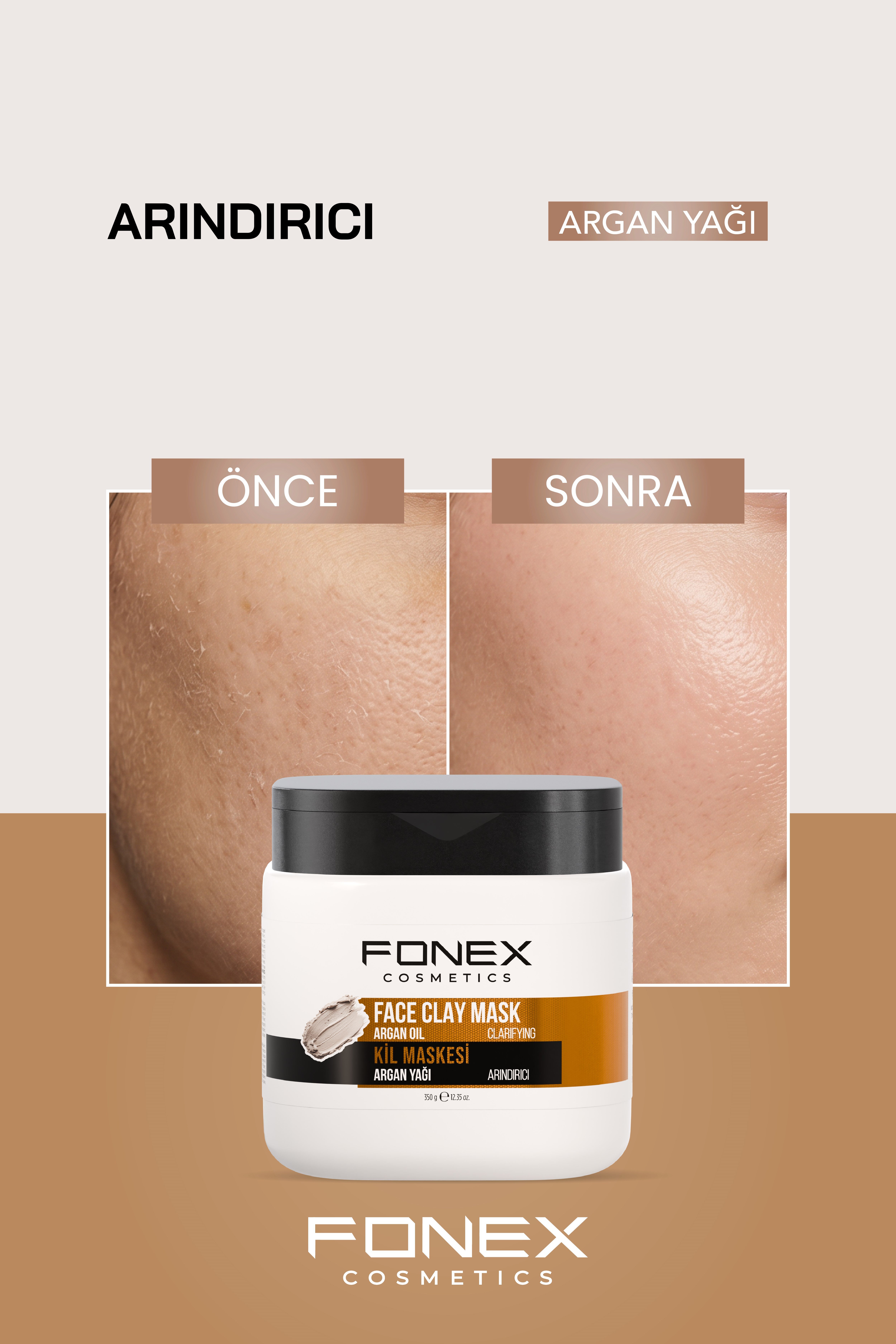 Fonex Kil Maskesi Argan Yağı 350 Gr 