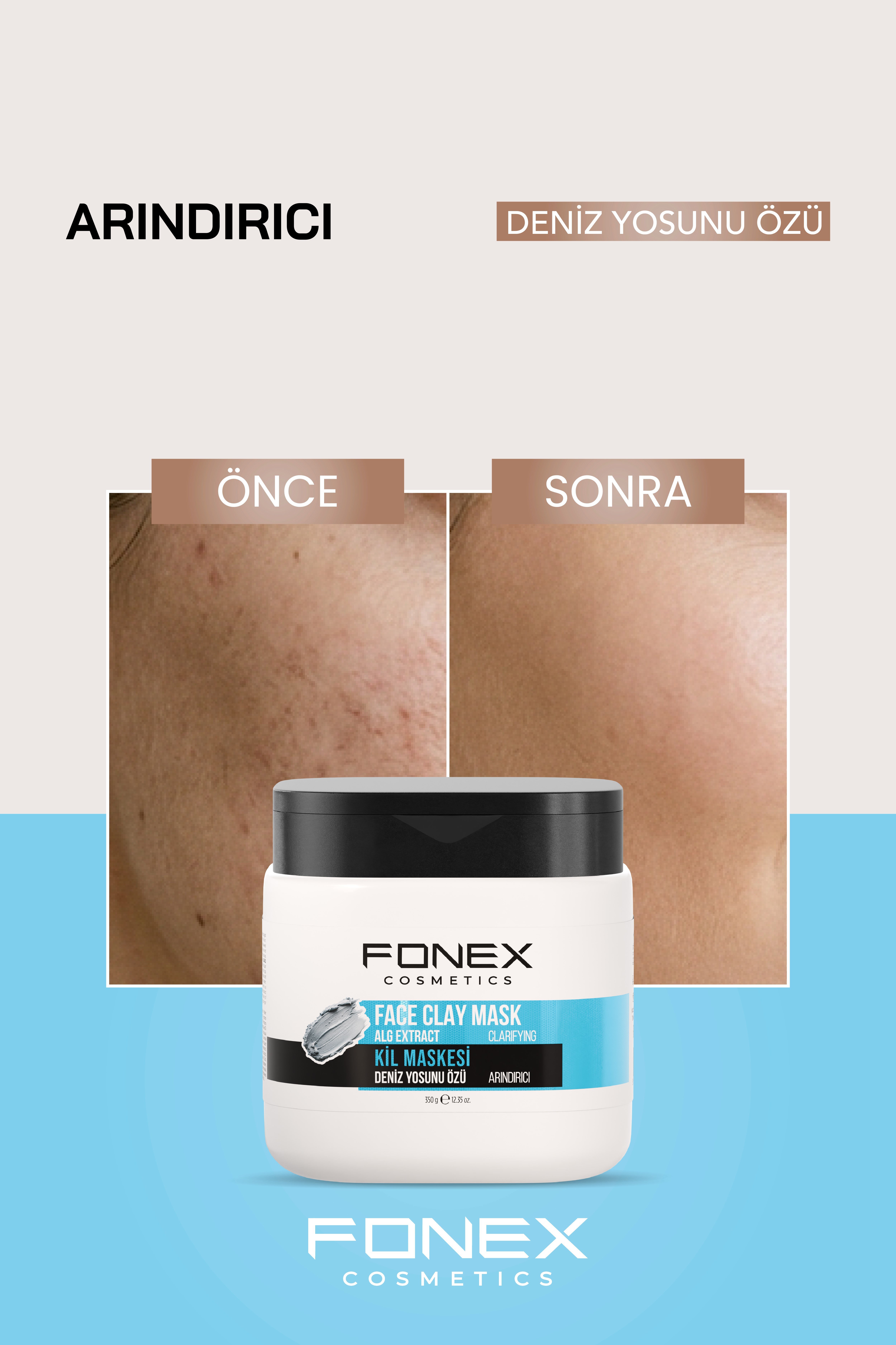Fonex Kil Maskesi Deniz Yosunu Özü 350 Gr 