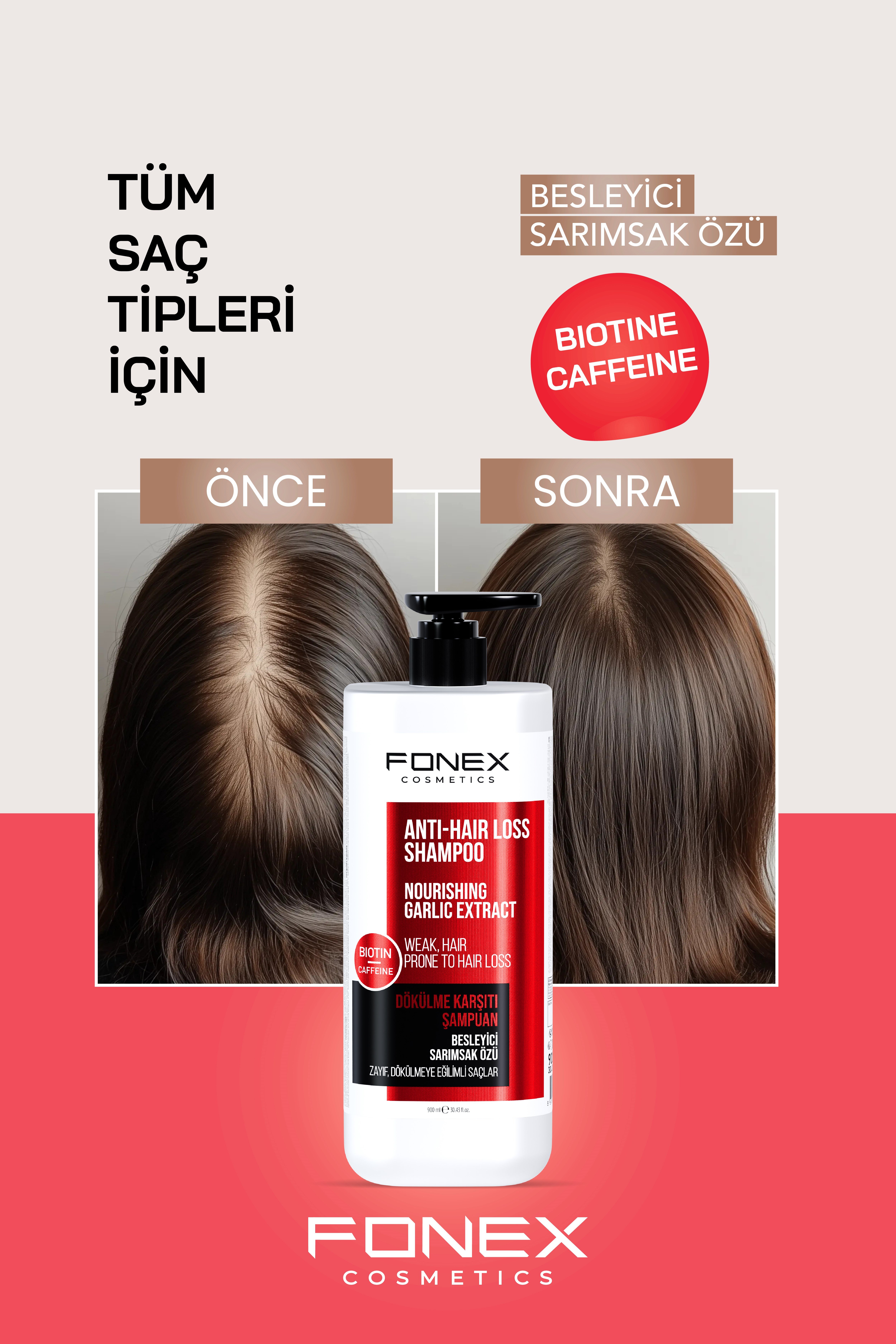 Fonex Şampuan Dökülme Karşıtı 900 ML 