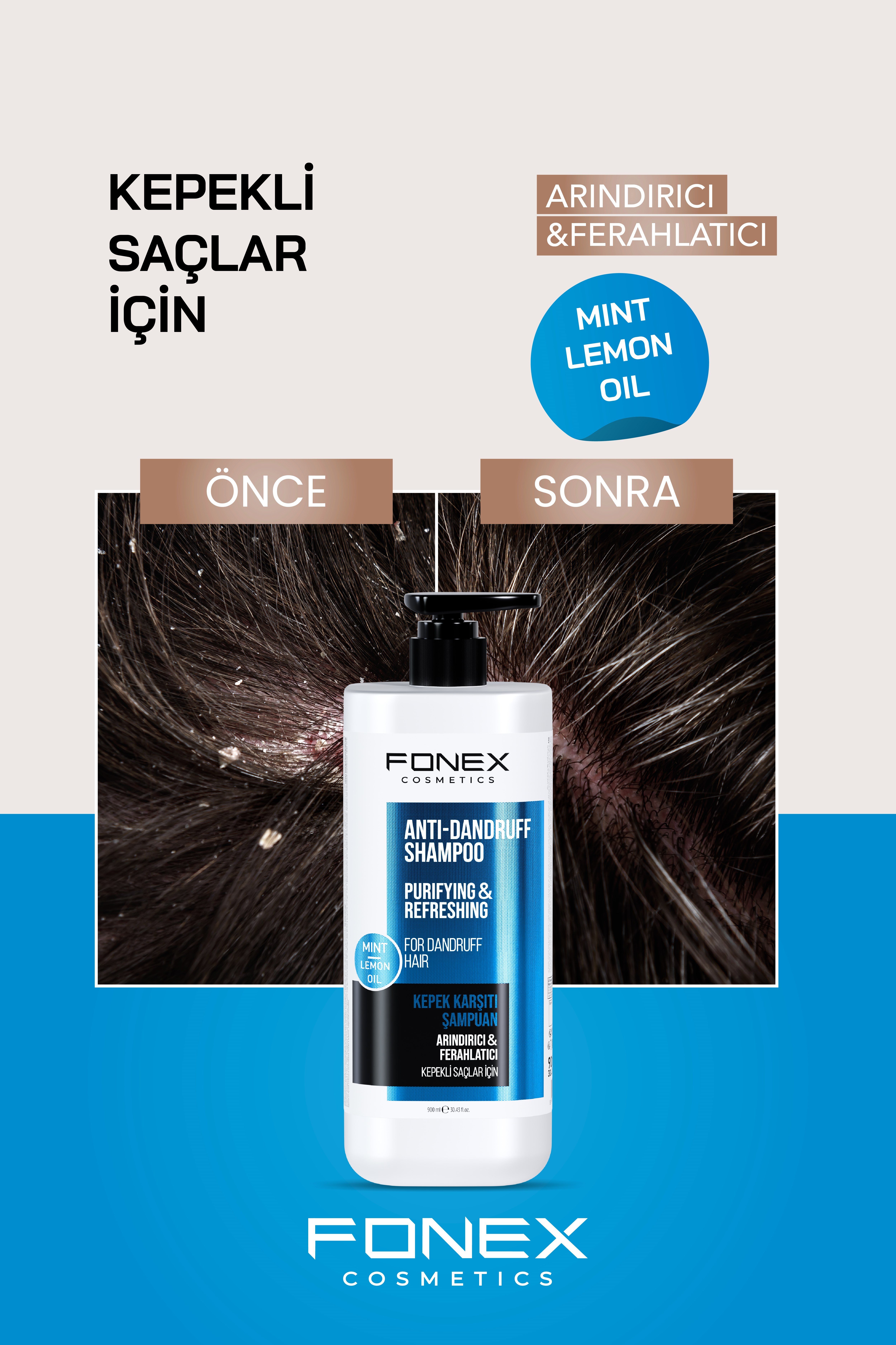 Fonex Şampuan Kepek Karşıtı 900 ML 