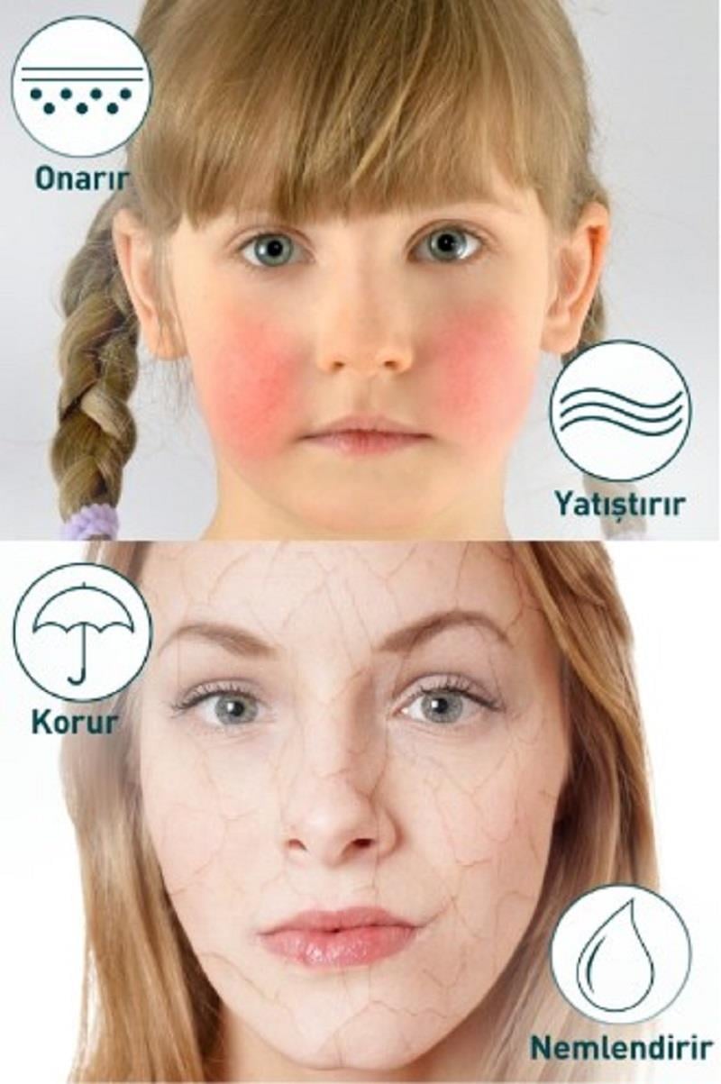 Bariederm Bariederm Plus Kuru Atopik Ciltler Onarıcı Bakım Kremi 75 ml
