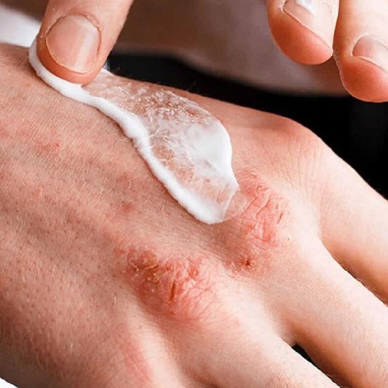 Ducray Ducray Dexyane Baume Anti Grattage Emollient Balm 400 ml