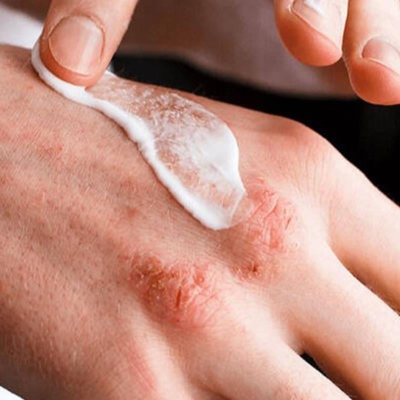 Ducray Ducray Dexyane Creme Emolliente Kaşıntı Karşıtı Krem 200 ml