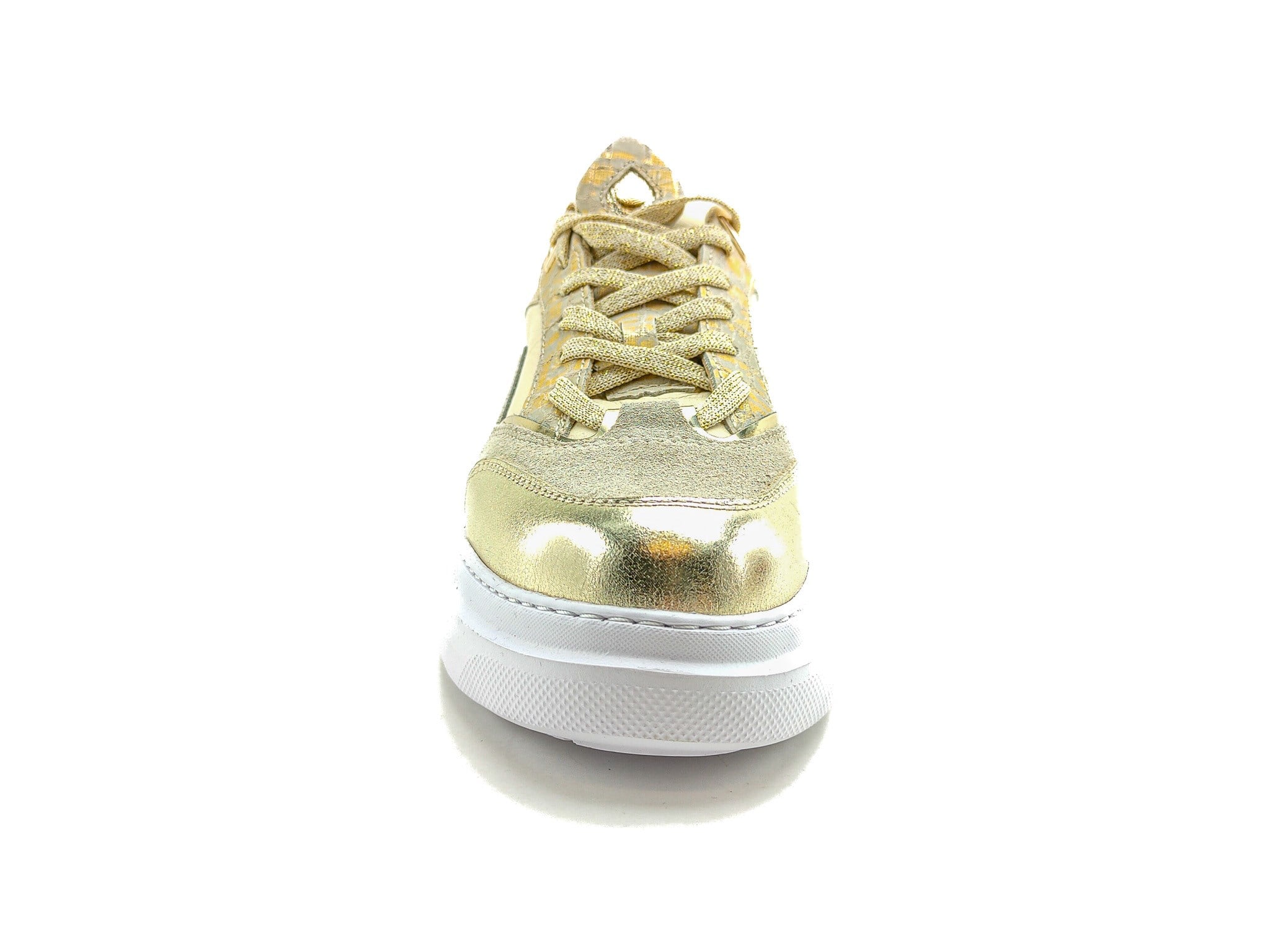 Ortoplus Deri Ortopedik Kadın Sneaker Ayakkabı ET3248 ALTIN - OrtoPlus