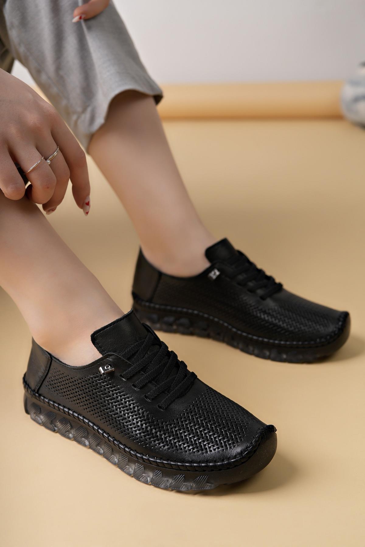 Castle Black 22384 Siyah Hakiki Deri Şeffaf Taban Kadın Sneakers