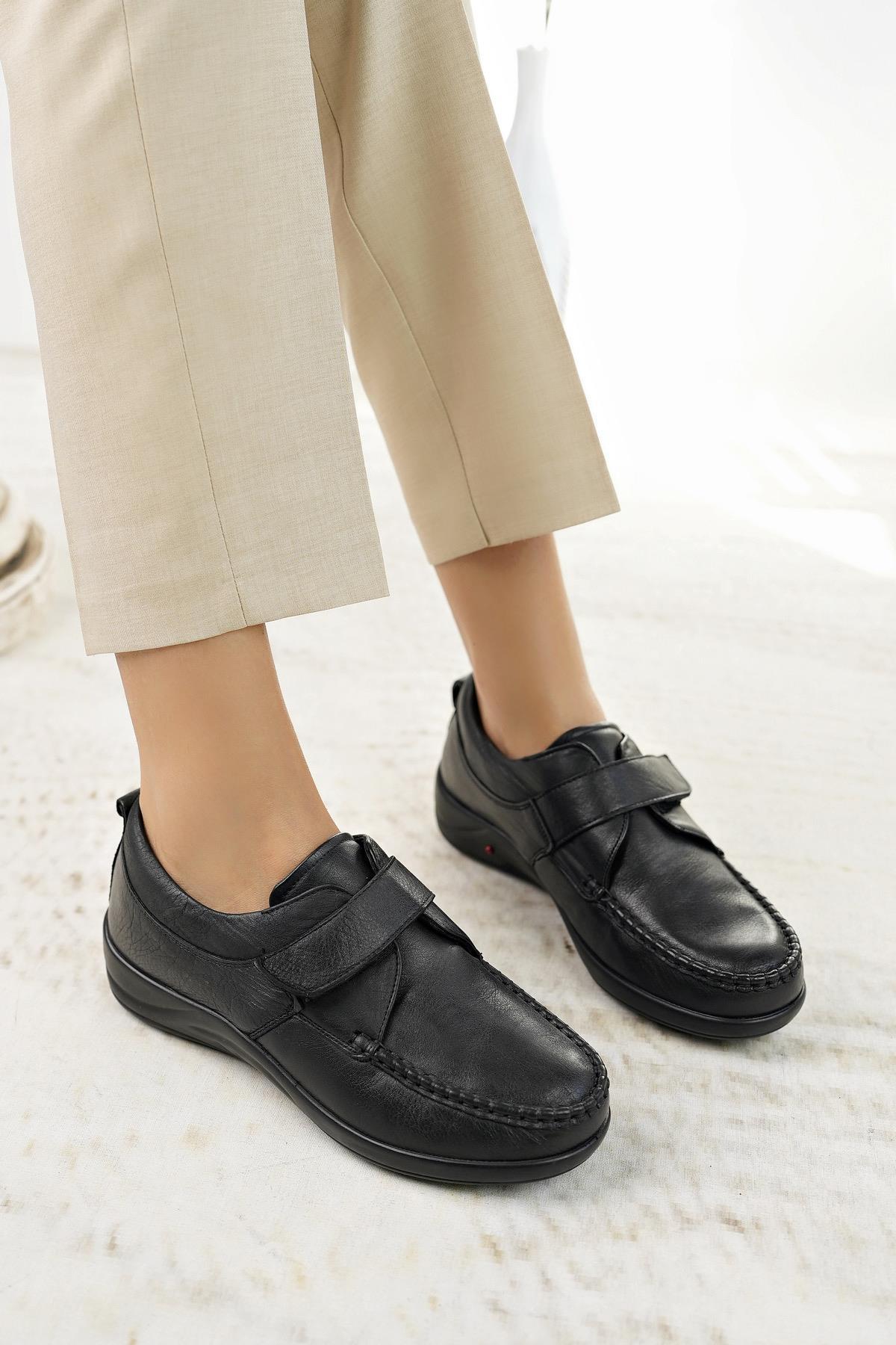 Forex 207 Siyah Hakiki Deri Cırtlı Anatomik Kadın Ayakkabı