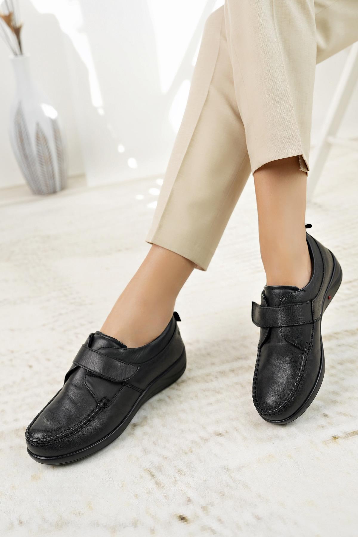 Forex 207 Siyah Hakiki Deri Cırtlı Anatomik Kadın Ayakkabı