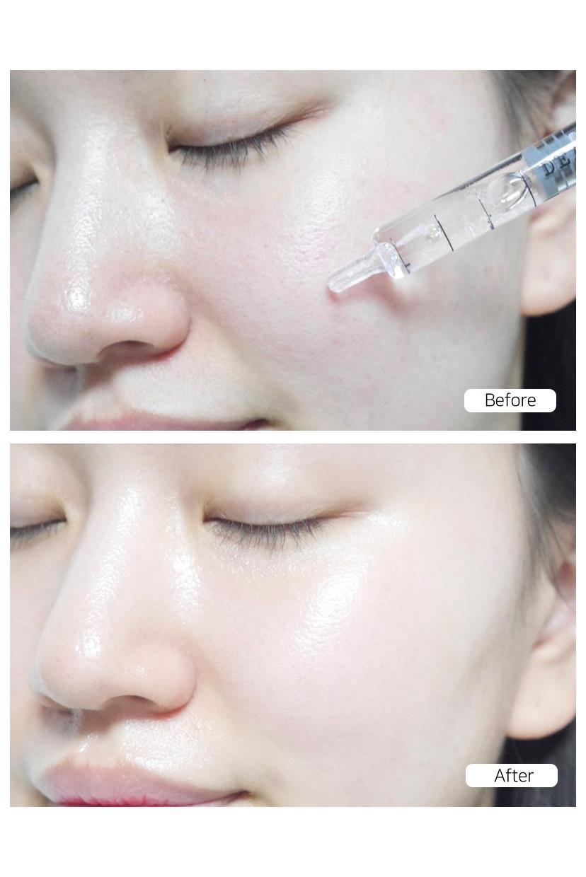 Dearglam -Aydınlatıcı Serum- Glutathione Liposomal 12.5 Brightening Serum