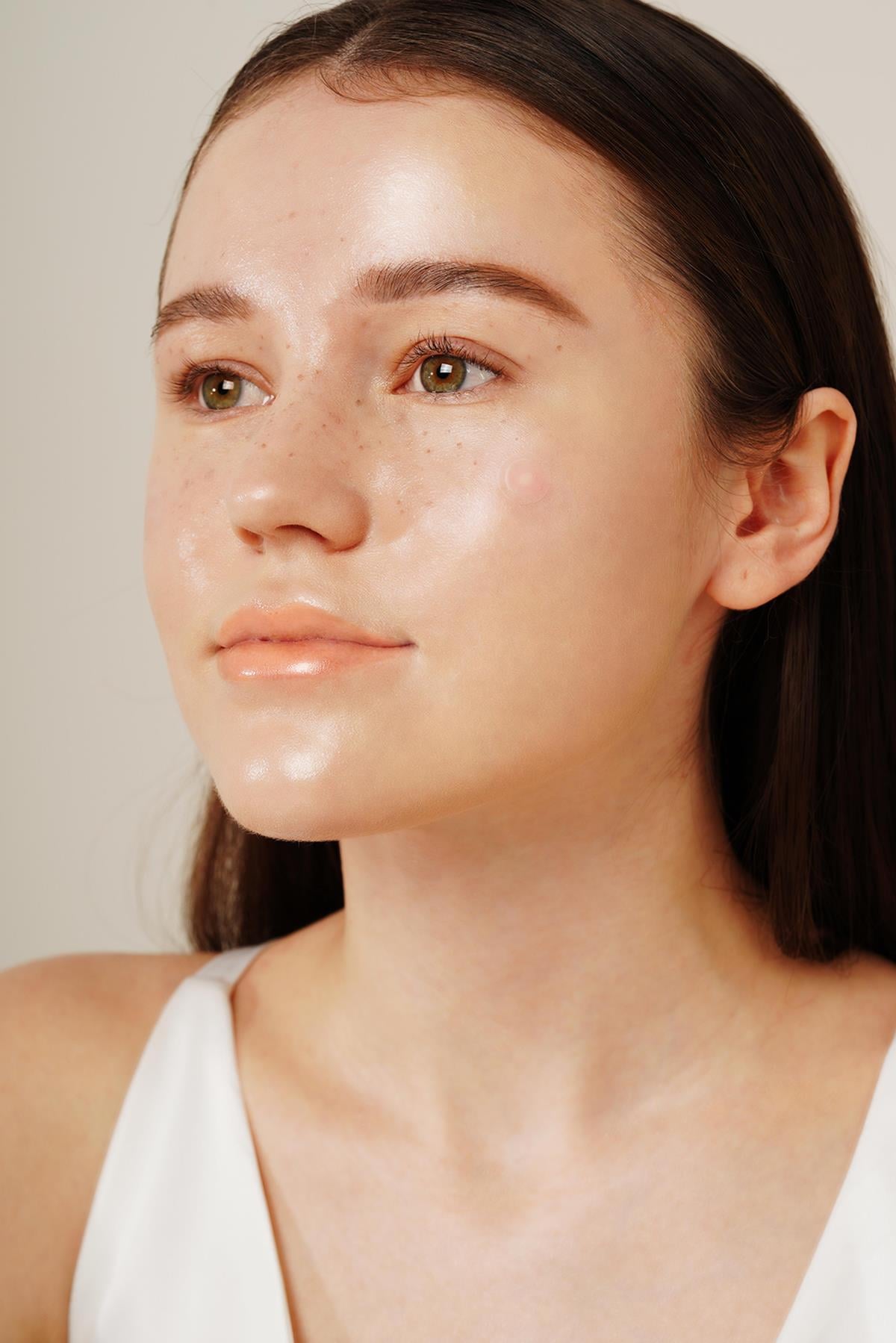 Onion Newpair Spot Patch - Skin Fit 12 mm 15 Adet (Niacinamide İçeren Akne Kapatıcı, Makyaj Öncesi Sivilce Bandı)