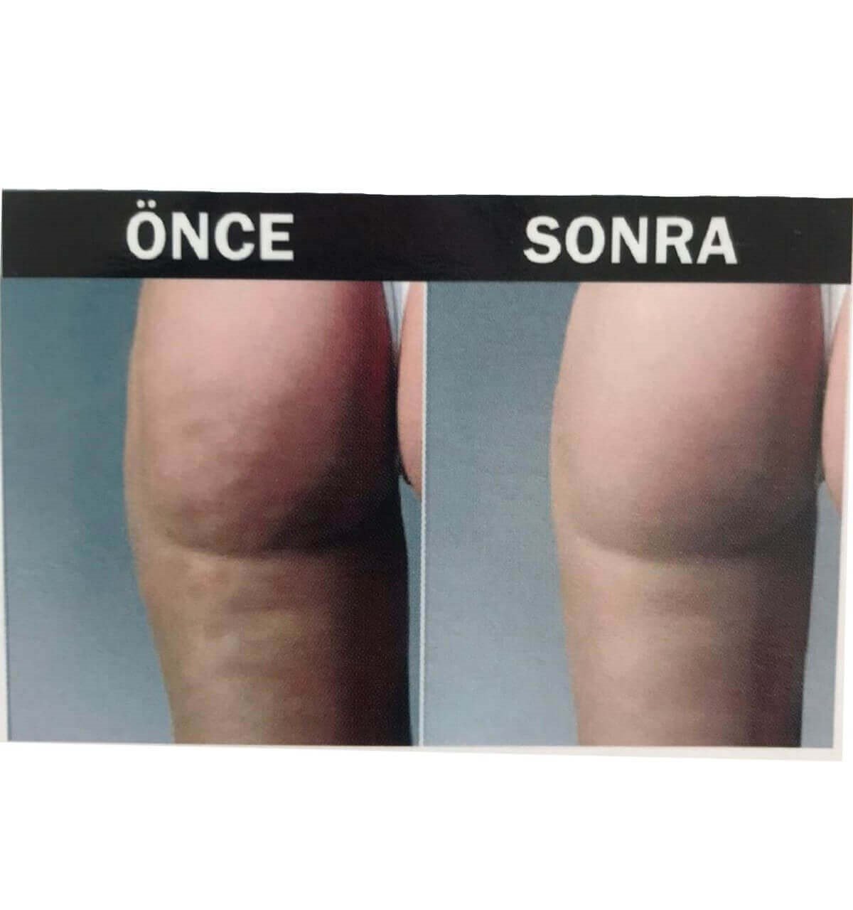 Hema Kadın Anti-Cellulite ( Selülit Giderici ) Masajlı Dikişsiz Paçalı Korse
