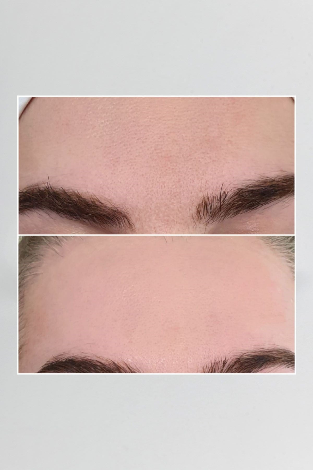 Pepplus+ Super Lifting - Face Lifting ve Sıkılaştırma Seti 8'li | Pepplus