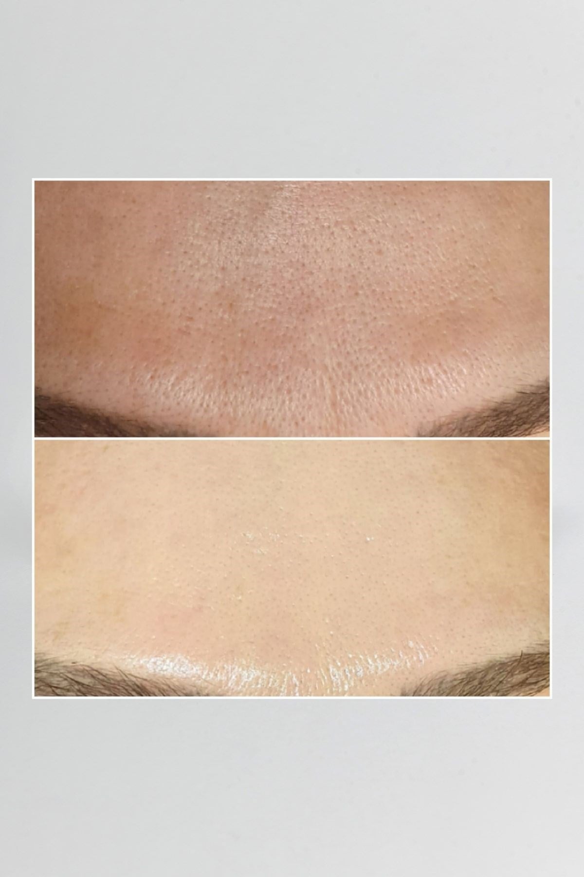 Pepplus+ Super Lifting - Face Lifting ve Sıkılaştırma Seti 4'lü | Pepplus