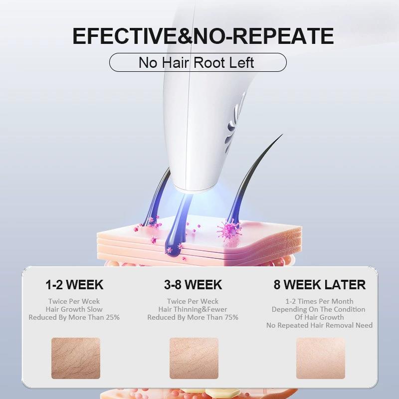 Buyfun Ipl Epilasyon Cihazı