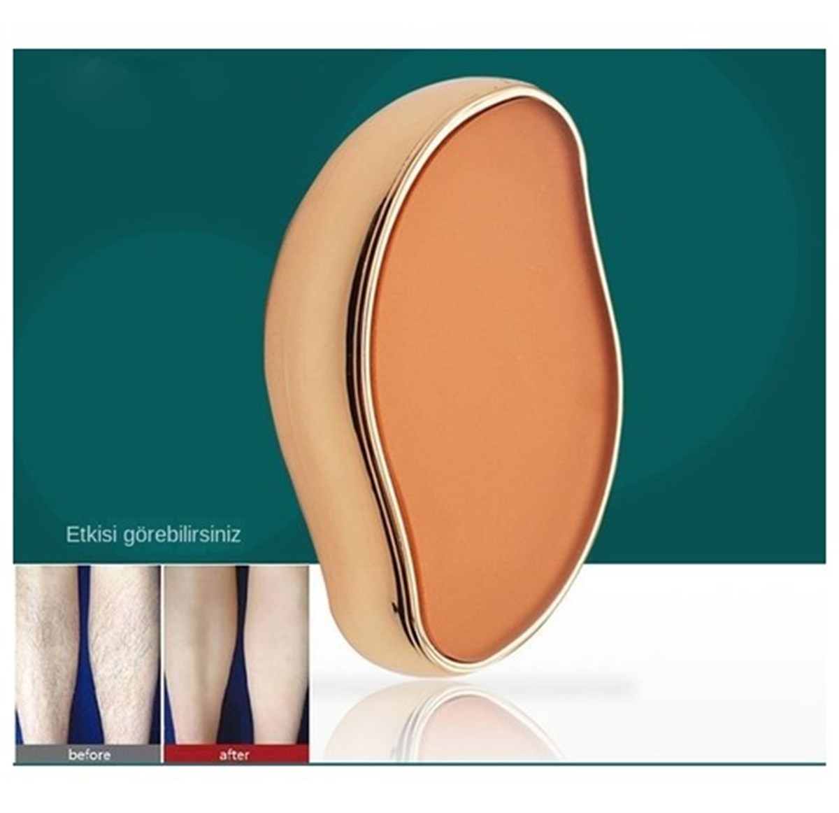 QingYu Ağrısız Tüy Dökücü Epilasyon Aleti - Altın