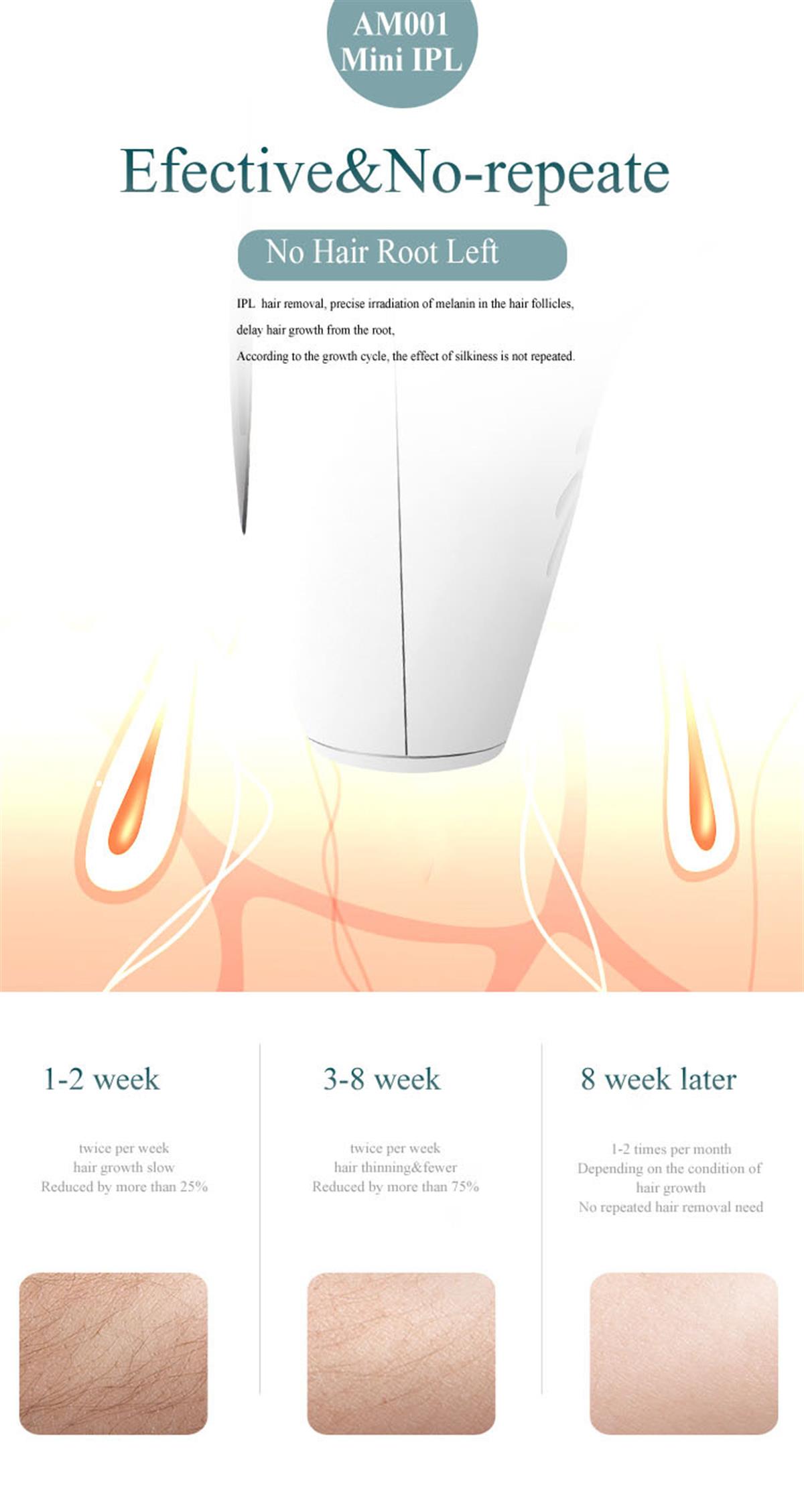 Tcherchi Kalıcı ve Ağrısız Tüm Vücut Epilasyonu için IPL Epilasyon Cihazı