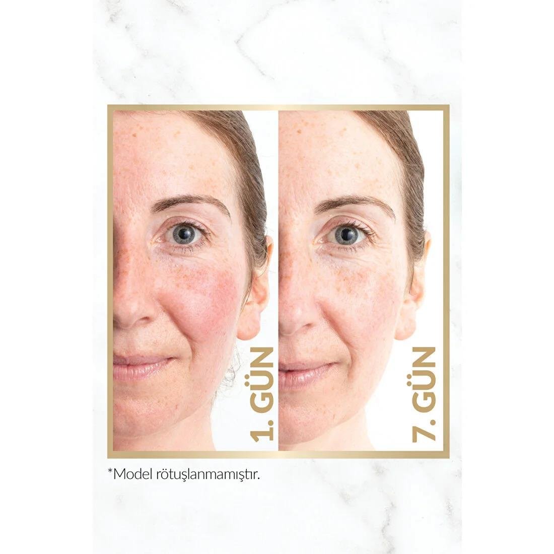 Avon Anew Renewal Power Serum 10 ml