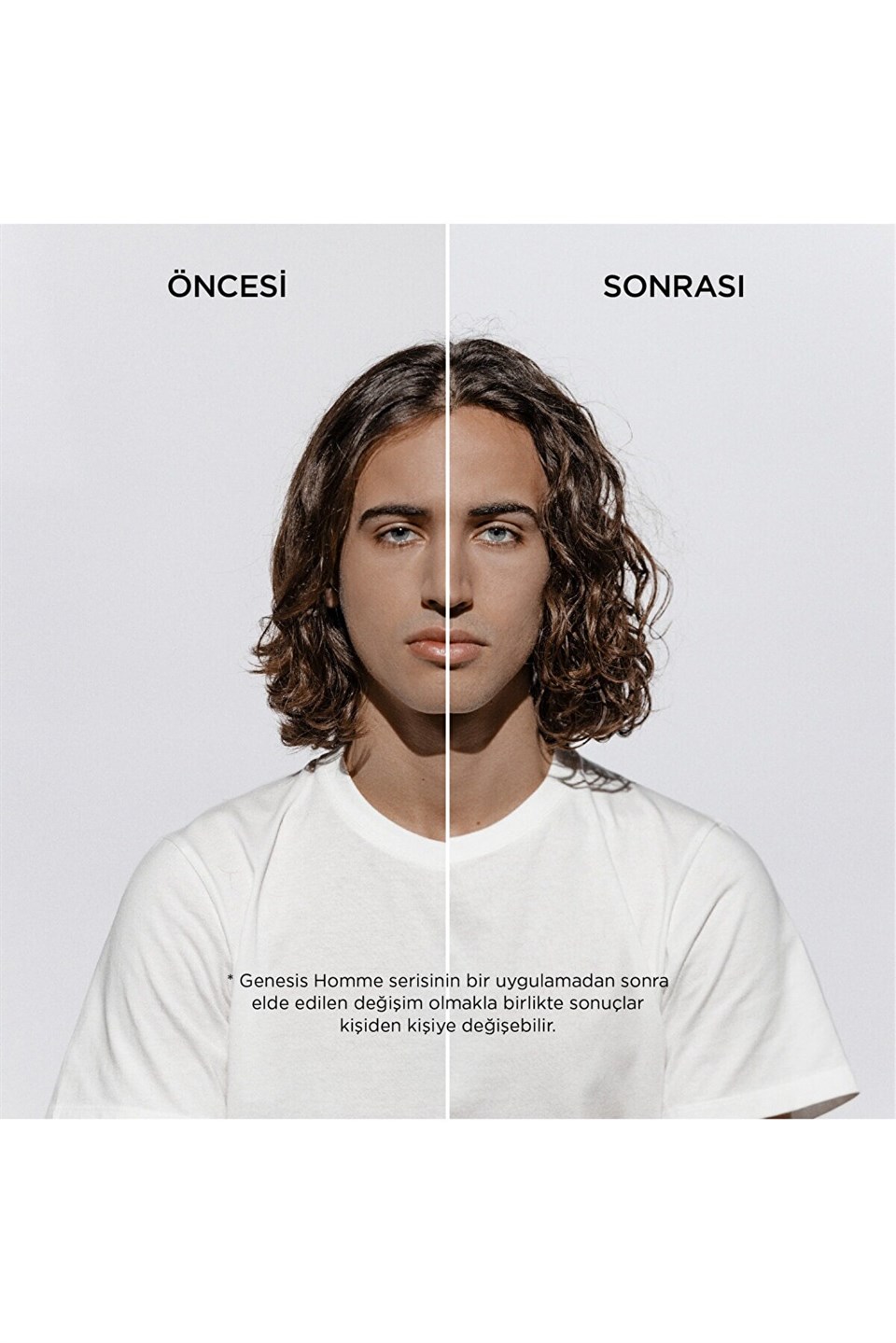 Genesis Homme, Saç Dökülmesine Karşı Güçlendirici Serum 90ml Çizgi Shop'da.