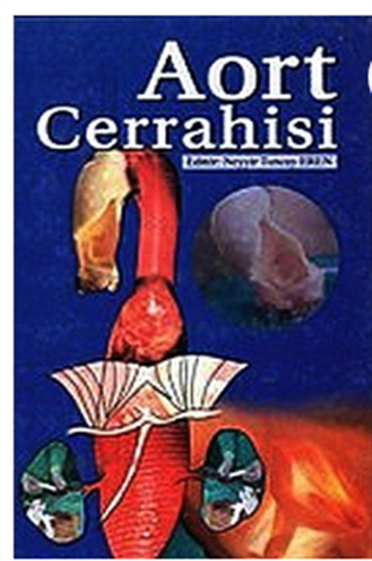 Aort Cerrahisi
