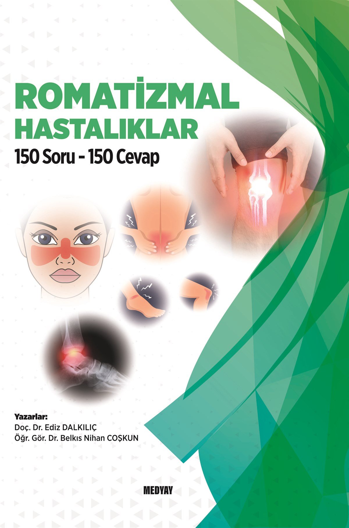 Romatizmal Hastalıklar 150 Soru 150 Cevap