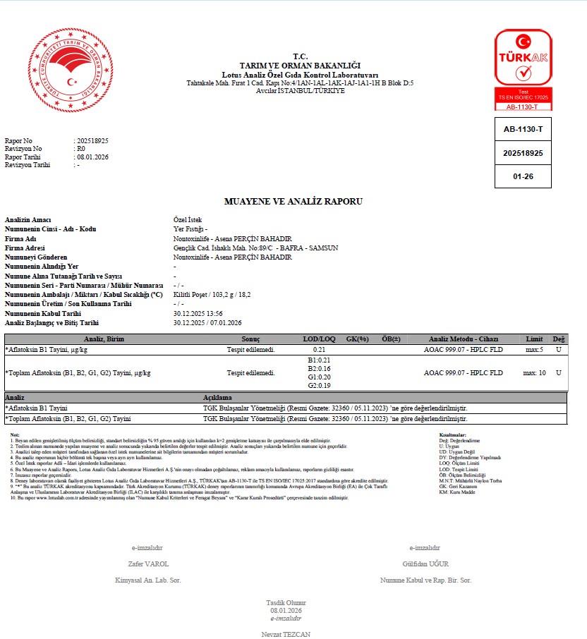 Çiğ Zarsız Yer Fıstığı