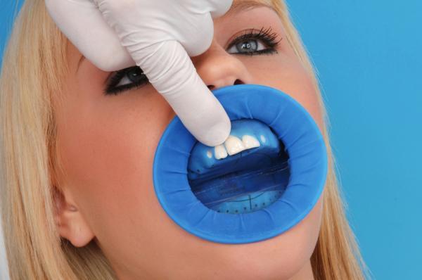 İvoclar Optradam Plus Rubberdam 50'lik