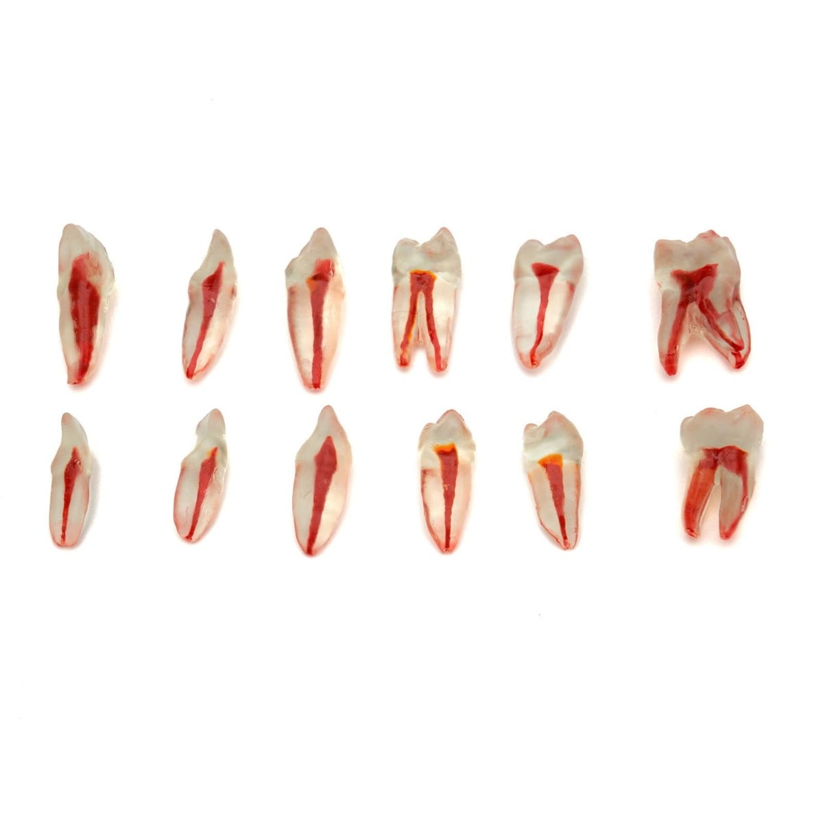 Omega Endodontik Şeffaf Kanallı Köklü Dişler