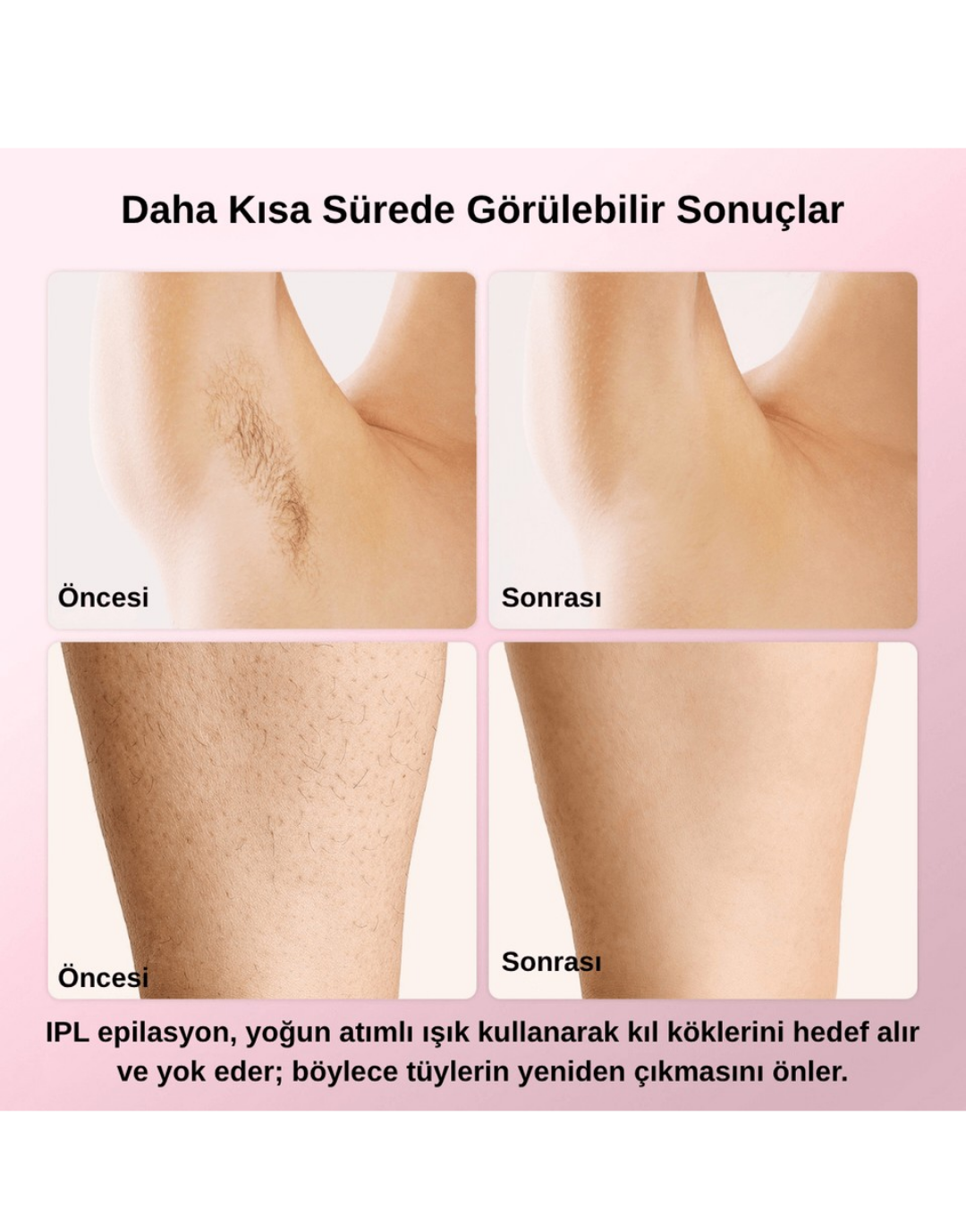 Pure Es T4 Taşınabilir IPL Lazer Epilasyon Cihazı