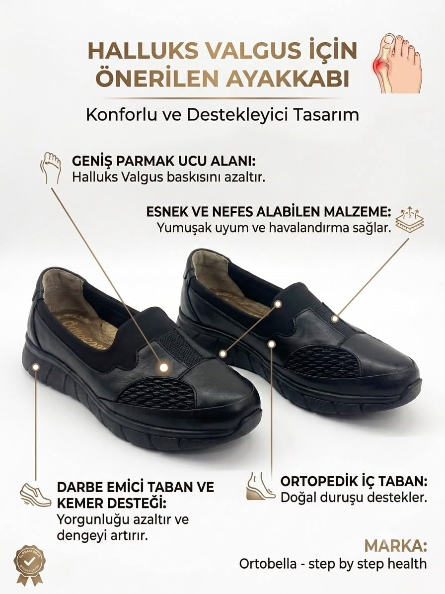 Ortobella Baş Parmak Kemik Çıkıntılı Günlük Doğal Deri Comfort Kadın Ayakkabı 823691