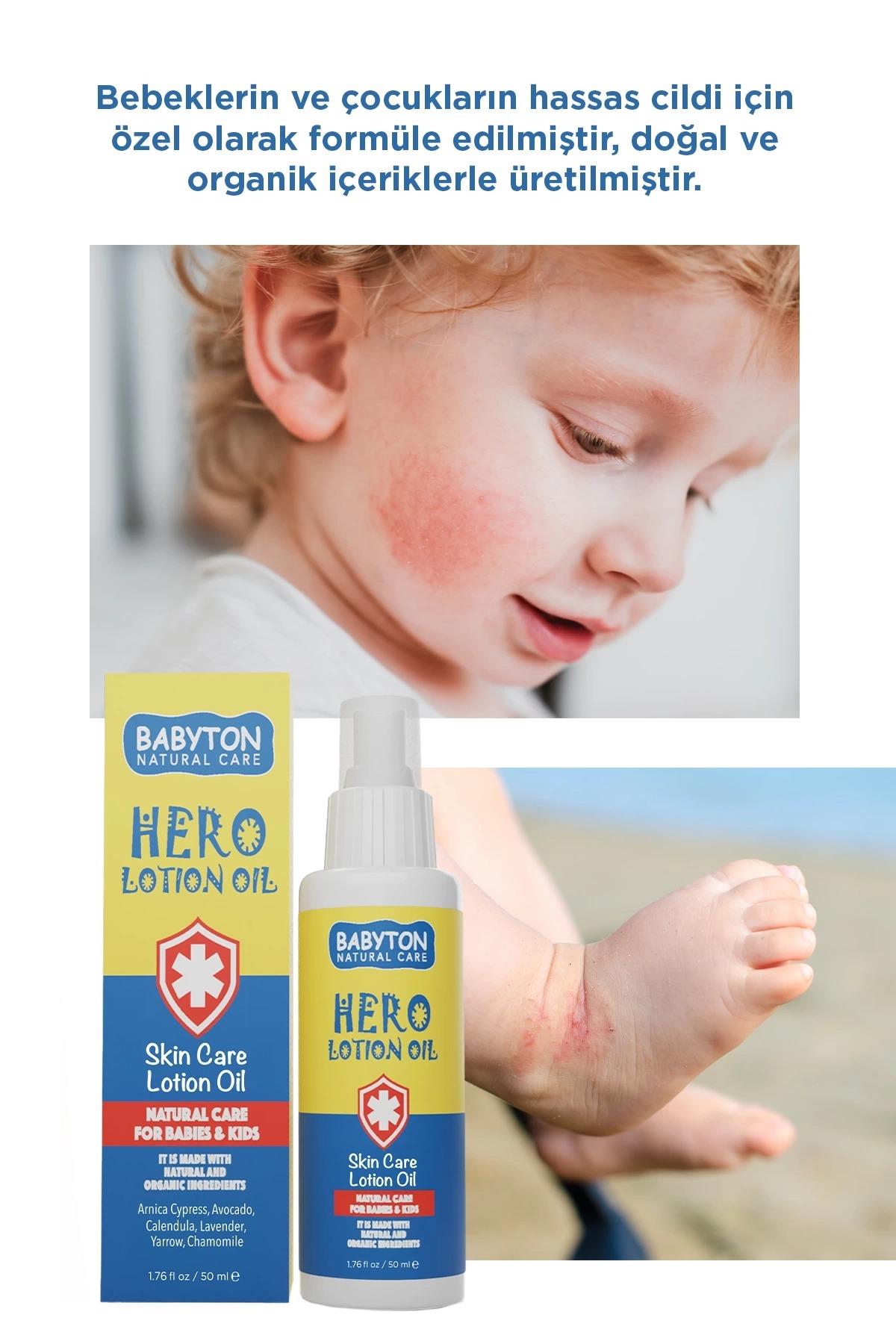 Babyton-Hero Losyon