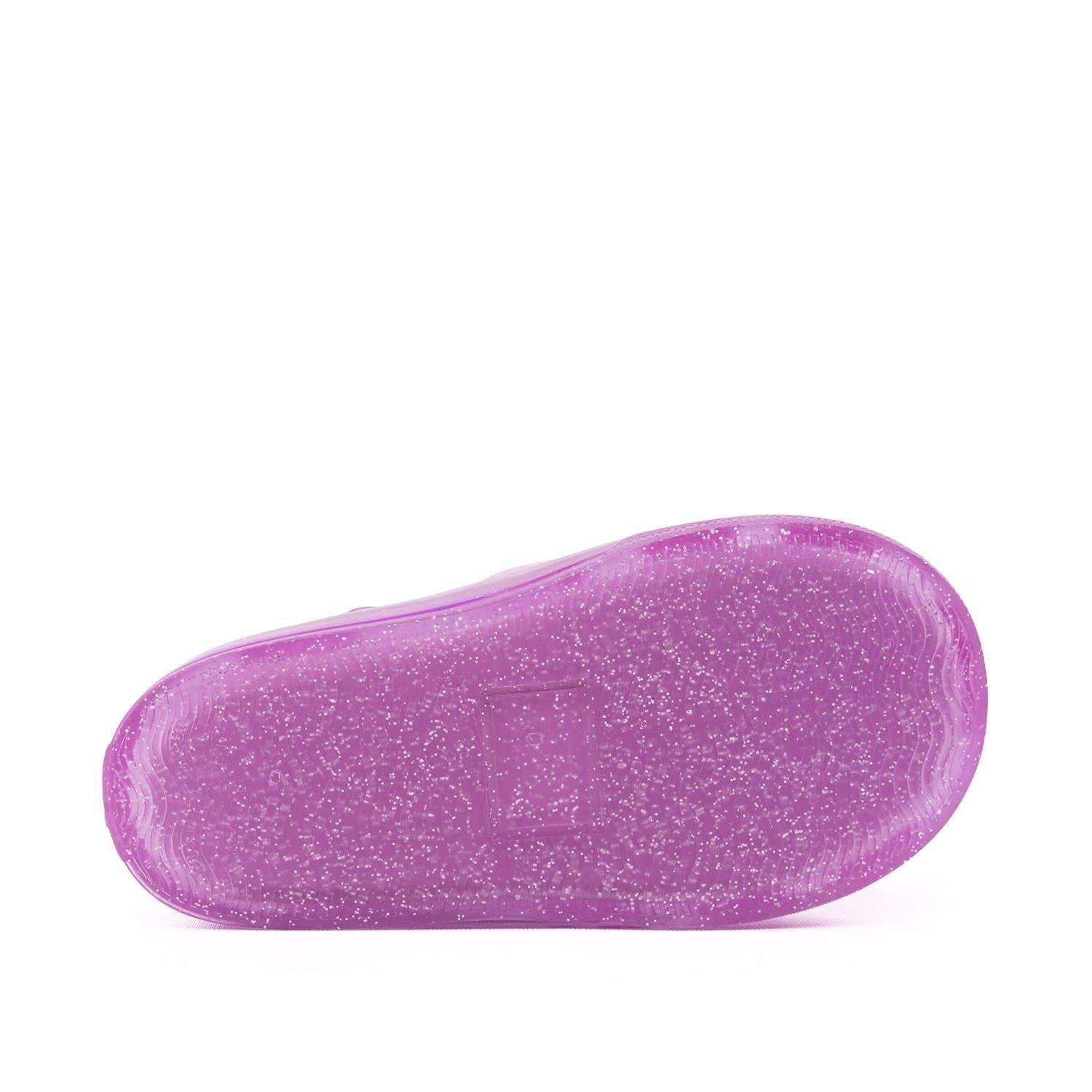 İgor Star Glitter Bebek-Çocuk Sandalet S10265