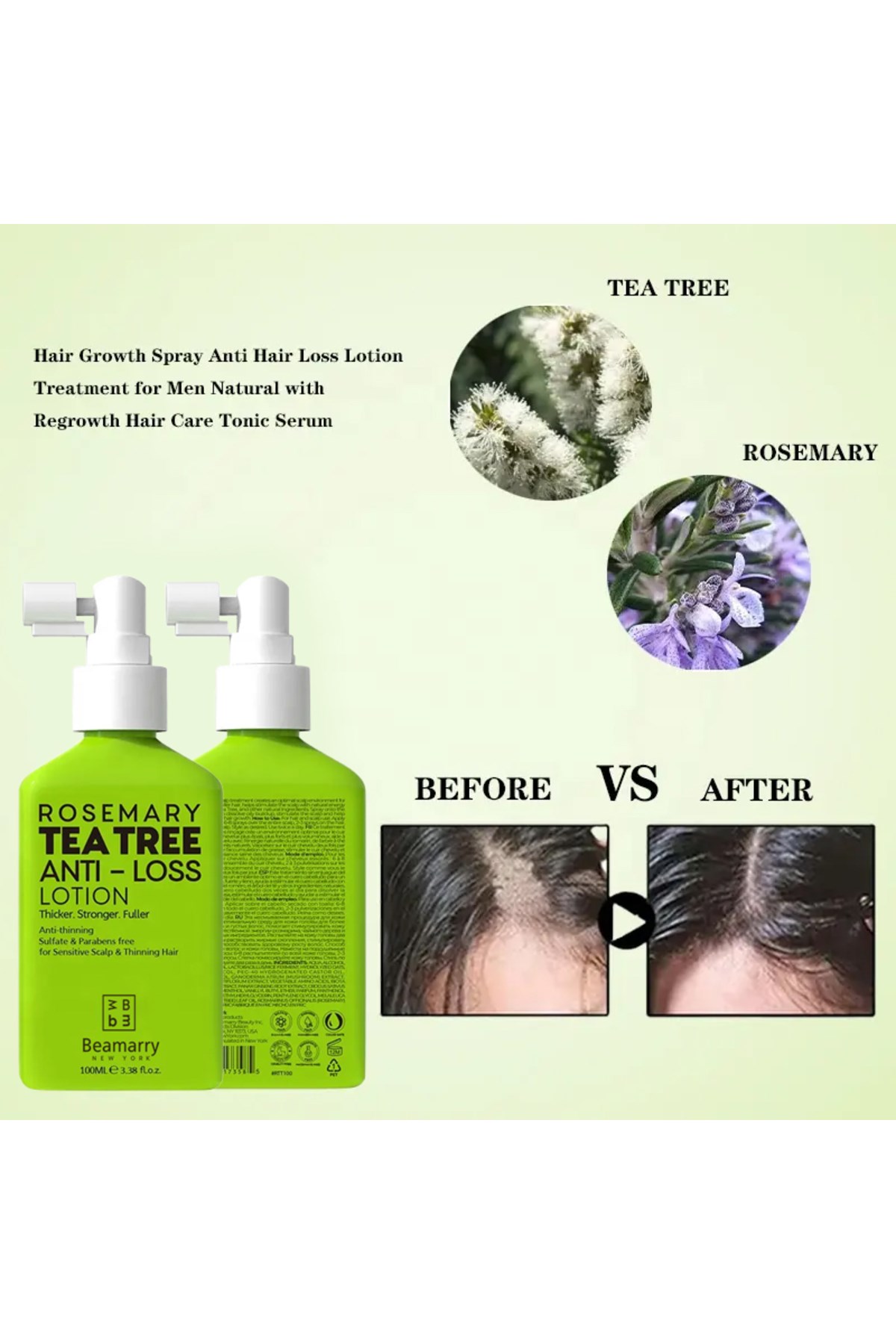 BeaMarrySAÇ SERUMLARIBeamarry Rosemary Tea Tree Anti Loss Lotion 100 ml