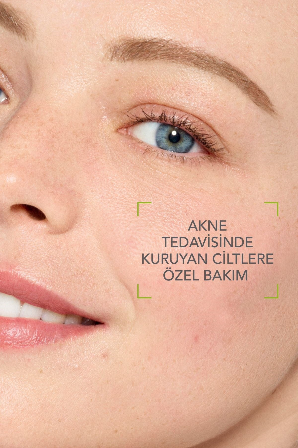 BİODERMACİLT BAKIM SETLERİBioderma Sebium İzokit + Sebium Hydra Cleanser 200 ml - Sebium Hydra 40 ml - Atoderm Levres 15 ml