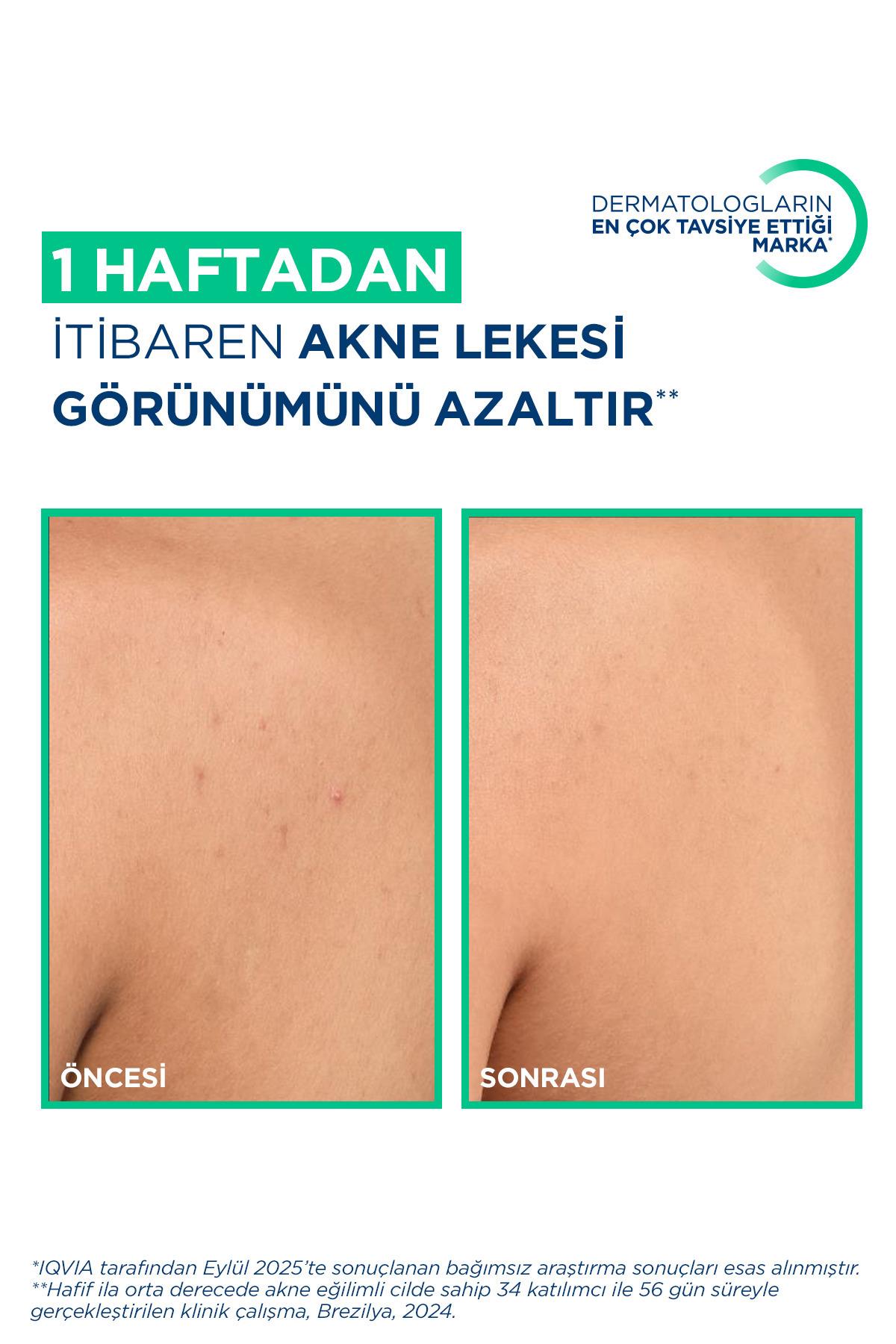 BİODERMAVÜCUT NEMLENDİRİCİLERBioderma Sebium Kerato Body Vücut Aknesi Karşıtı Sprey 150 ml 
