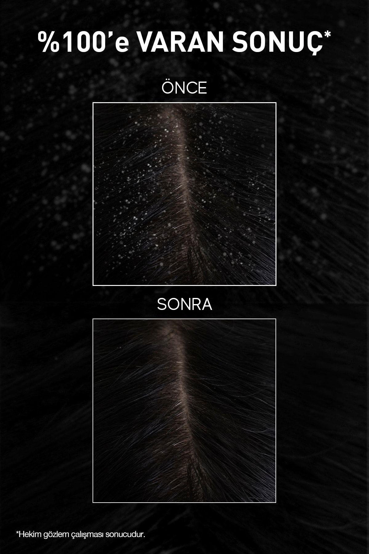 BİOXCİNŞAMPUANLARBioxcin Aqua Thermal Yoğun Kepek Karşıtı Şampuan 200 ml