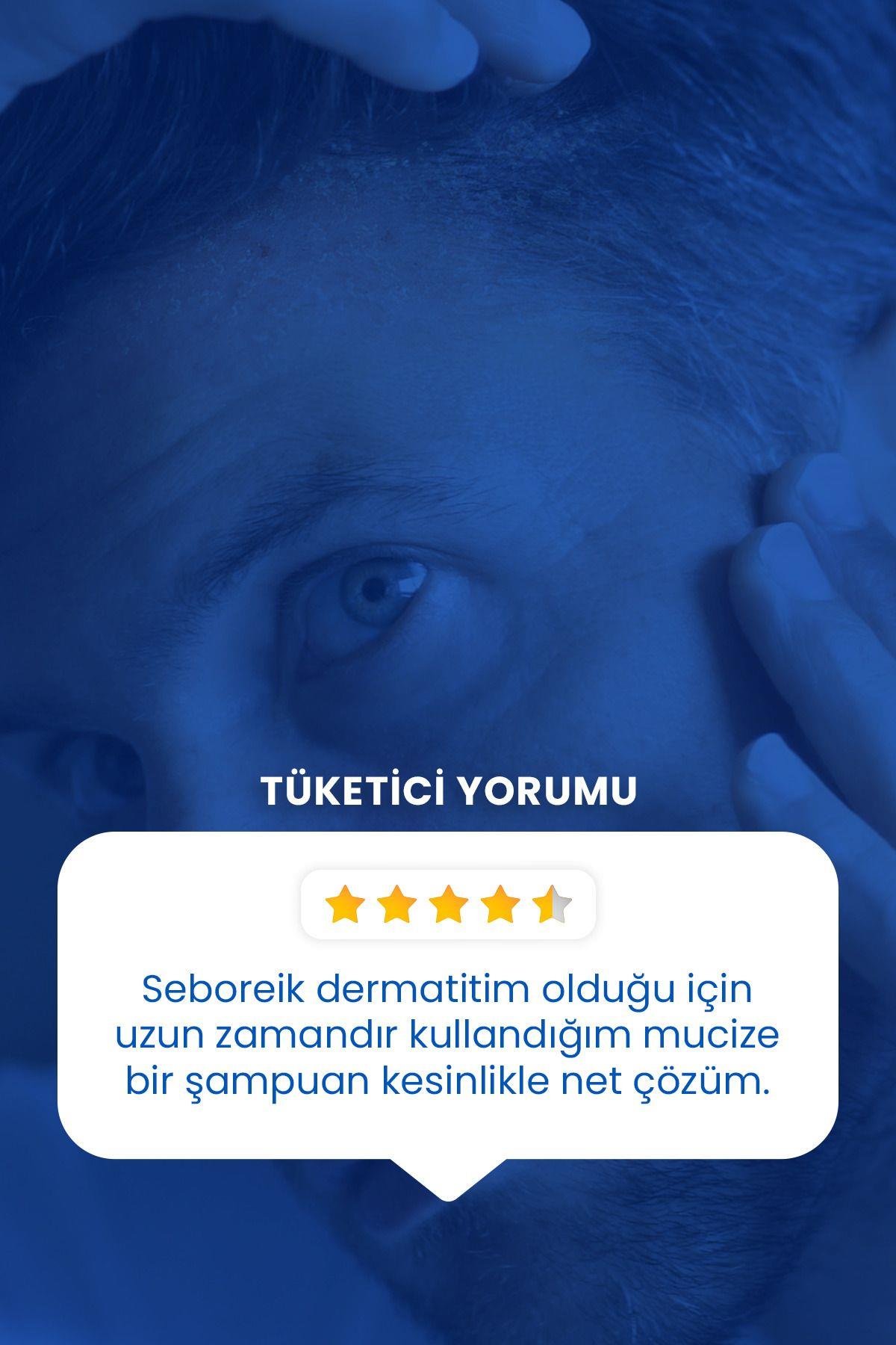 DUCRAYŞAMPUANLARDucray Kelual DS Şampuan 100 ml