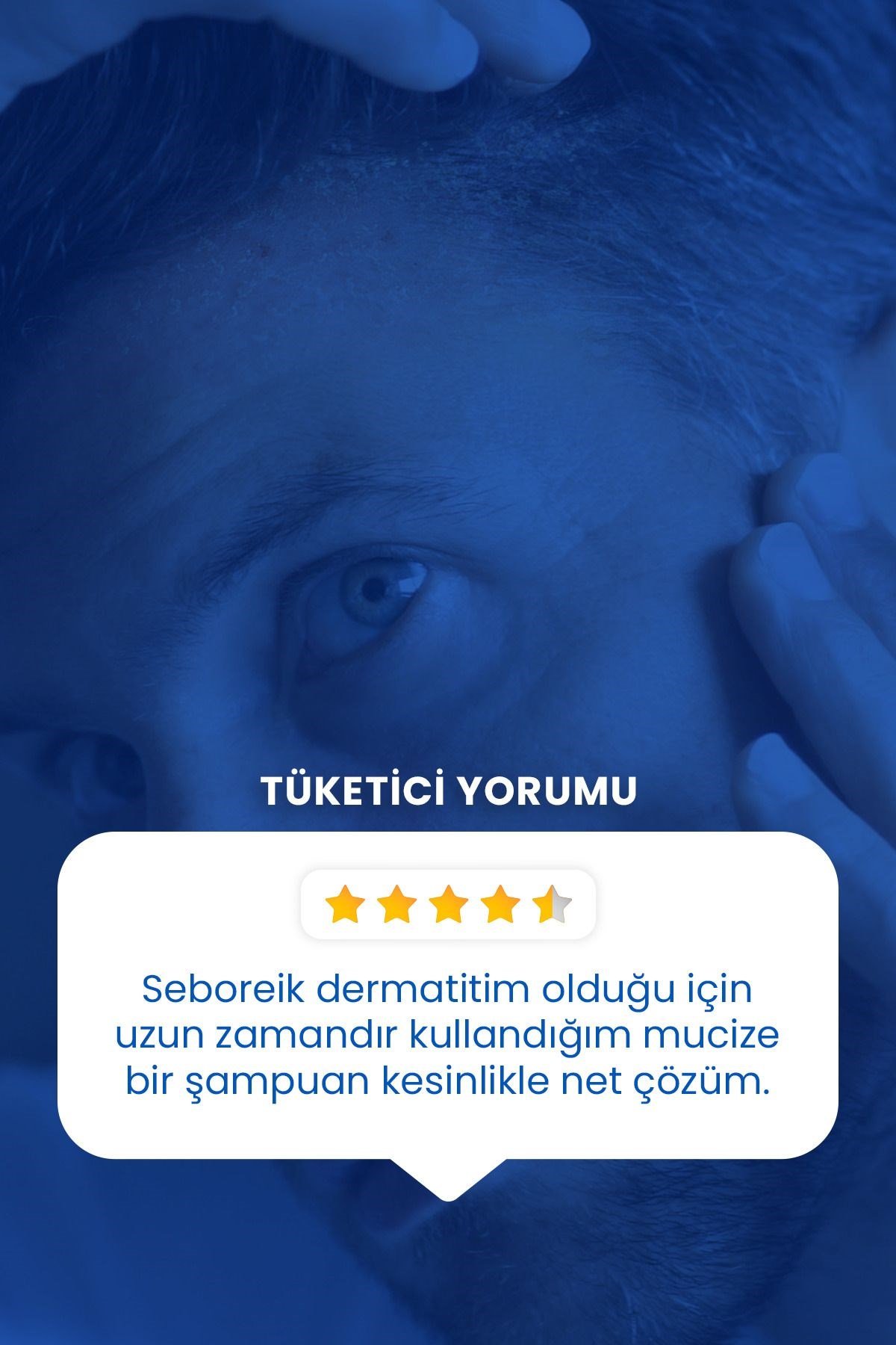 DUCRAYŞAMPUANLARDucray Kelual DS Şampuan 100 ml