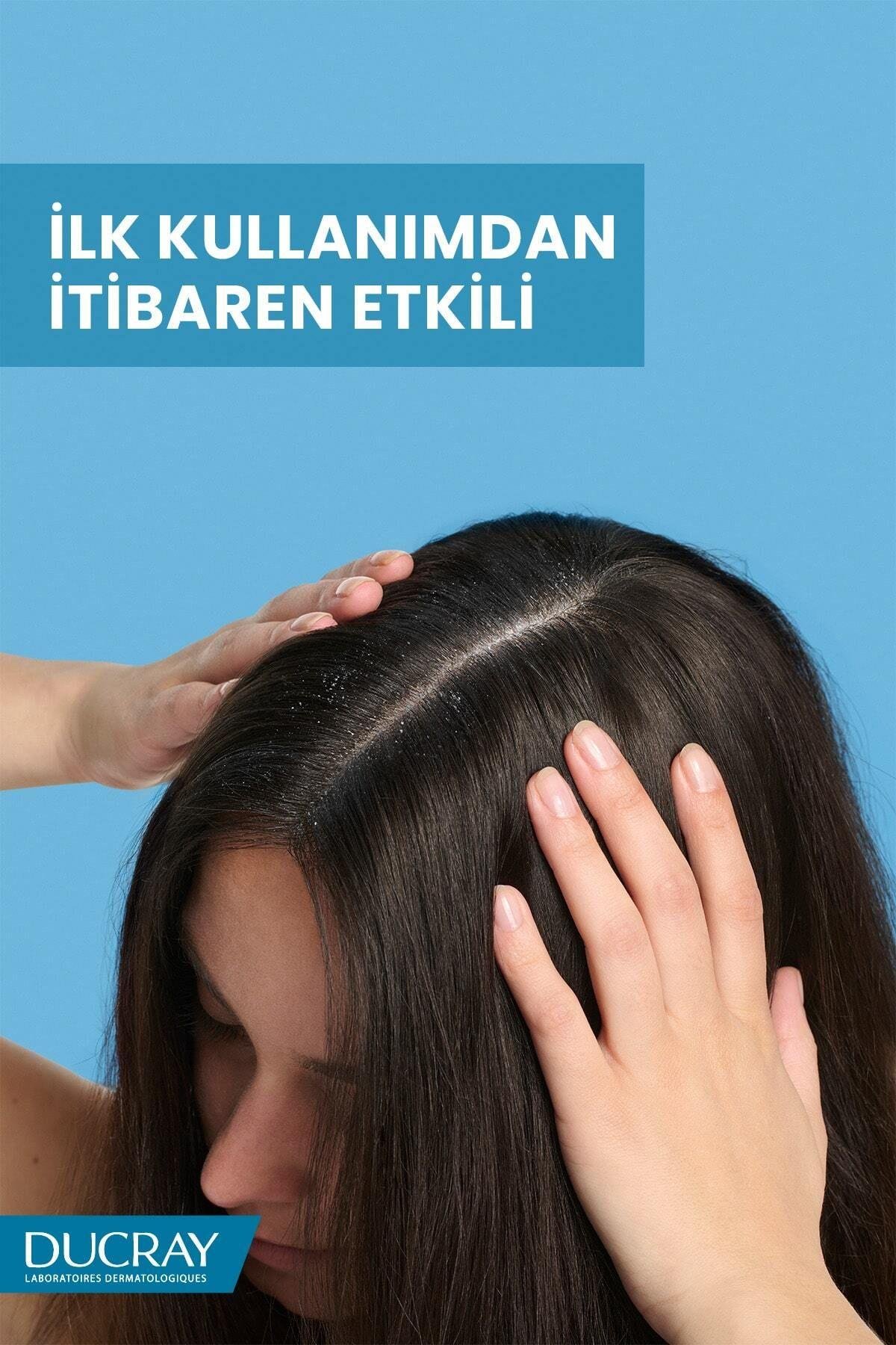 DUCRAYŞAMPUANLARDucray Kelual Squanorm Normal ve Yağlı Saçlar İçin Kepek Karşıtı Şampuan 400 ml