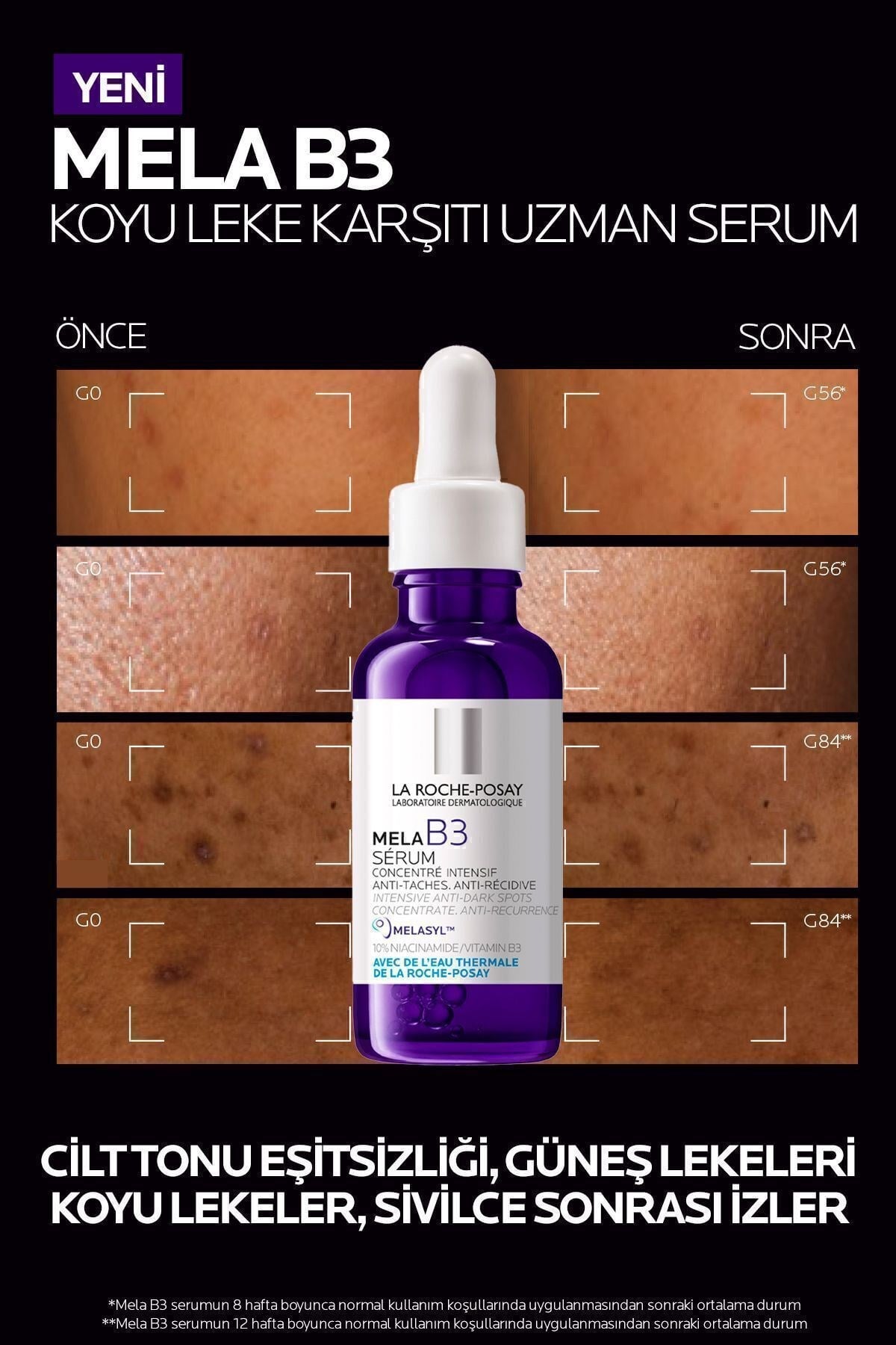 LA ROCHE POSAYCİLT BAKIM SERUMLARILa Roche Posay Mela B3 Leke Karşıtı Serum 30 ml