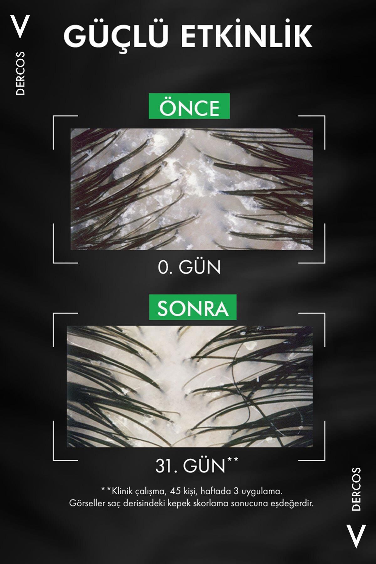 VichyŞAMPUANLARVichy Dercos Anti-Dandruff Şampuan Kepek Karşıtı Kuru Saçlar İçin 200 ml