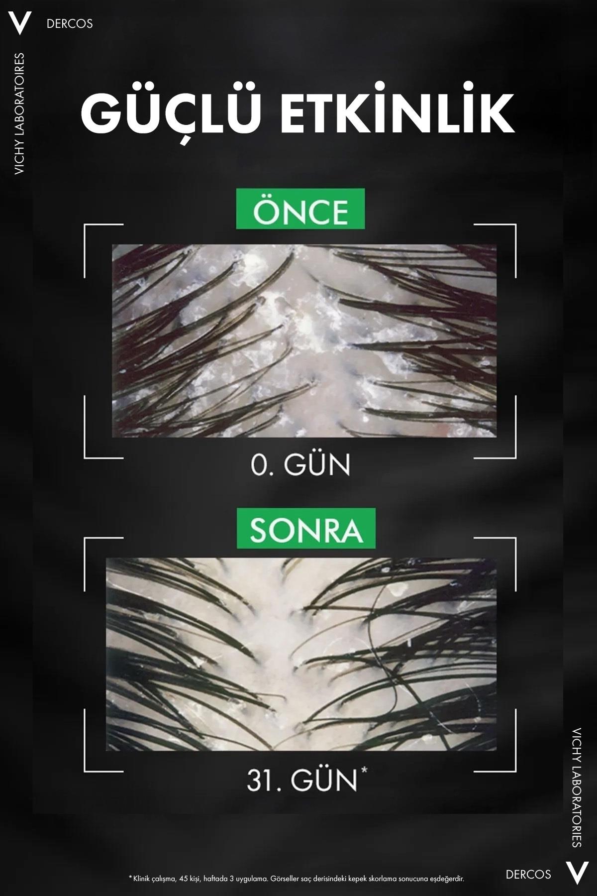 VichyŞAMPUANLARVichy Dercos Anti Dandruff Kuru Saçlar İçin Kepek Karşıtı Şampuan Refill 390 ml